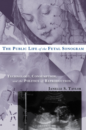The Public Life of the Fetal Sonogram